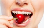 Braces-Friendly Foods: Tips for Healthy Eating During Treatment braces-friendly foods