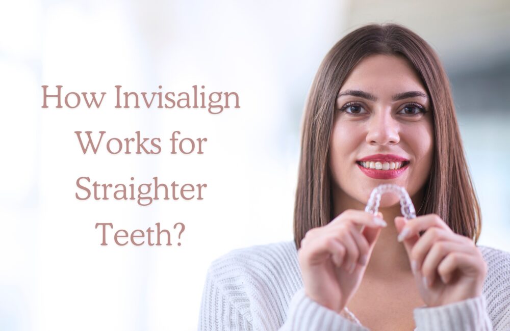 How Invisalign Works for Straighter Teeth? how invisalign works for straighter teeth 1