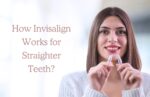 How Invisalign Works for Straighter Teeth? how invisalign works for straighter teeth 1