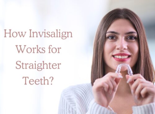 How Invisalign Works for Straighter Teeth? how invisalign works for straighter teeth 1