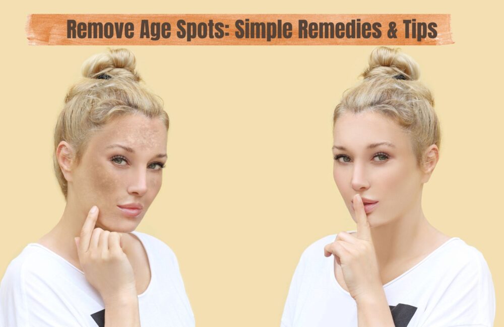 Remove Age Spots: Easy Remedies, Treatments & Prevention Tips for Clearer Skin Remove Age Spots Simple Remedies & Prevention Tips