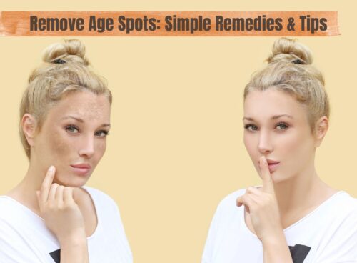 Remove Age Spots: Easy Remedies, Treatments & Prevention Tips for Clearer Skin Remove Age Spots Simple Remedies & Prevention Tips
